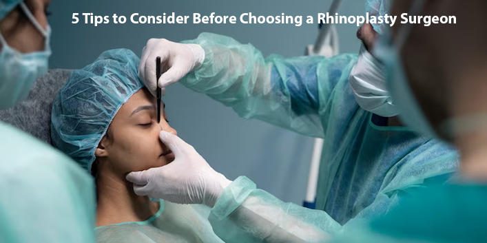 5 Tips to Consider Before Choosing a Rhinoplasty Surgeon