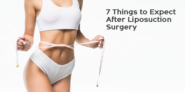 7 Things to Expect After Liposuction Surgery