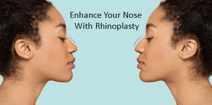 Enhance Your Nose With Rhinoplasty