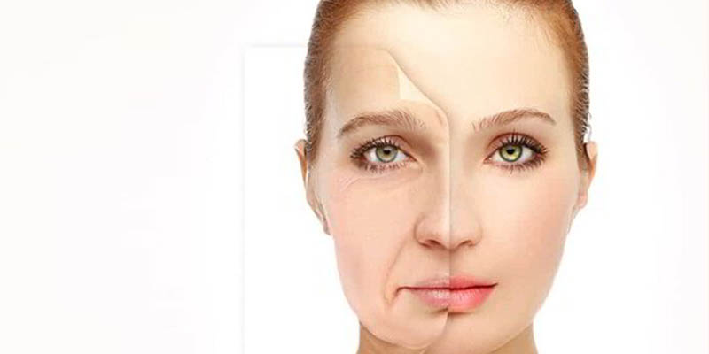 Everything you need to Know about Face Lift Surgery