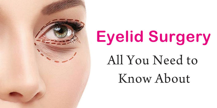 Eyelid Surgery – All you need to know about