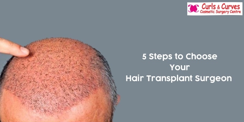 5 Important Things to choose your Hair Transplant