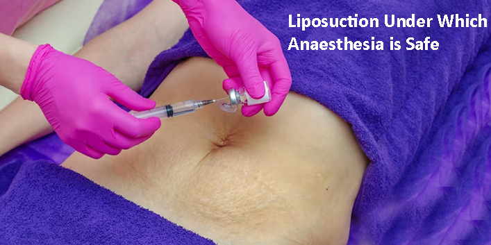 Liposuction Under Which Anaesthesia is Safe