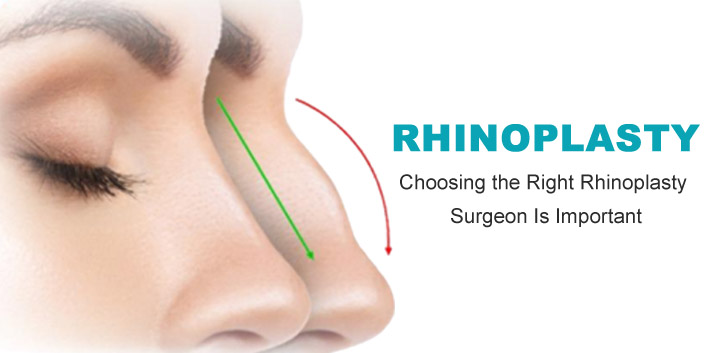 What to know before and after Rhinoplasty surgery ?