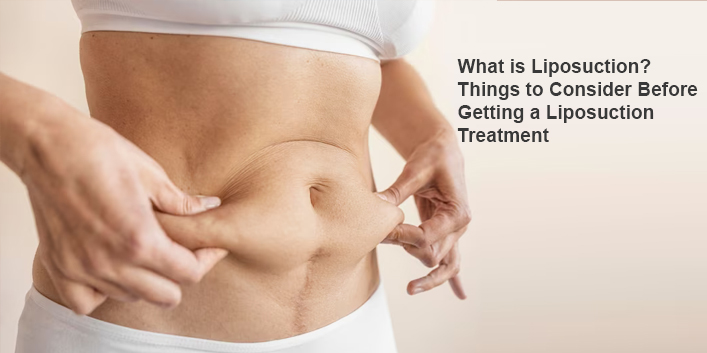 What is Liposuction? Things to Consider Before Getting a Lipos...