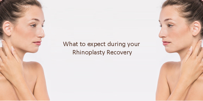 What to expect during your Rhinoplasty Recovery