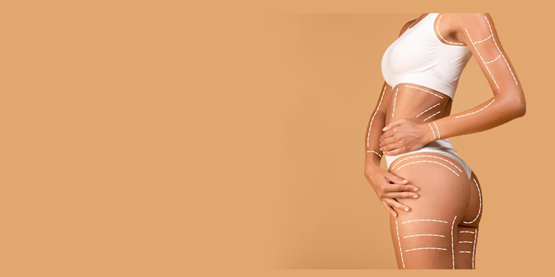 Get the perfect contours with Vaser HD Liposuction