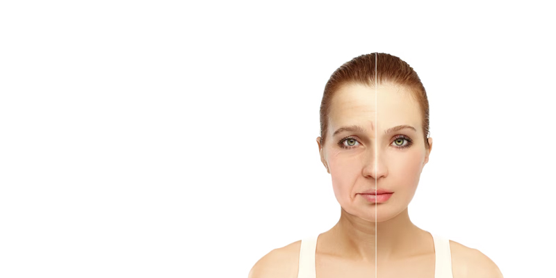 Deep Plane Facelift vs Traditional Facelift. Unveiling the Dif...