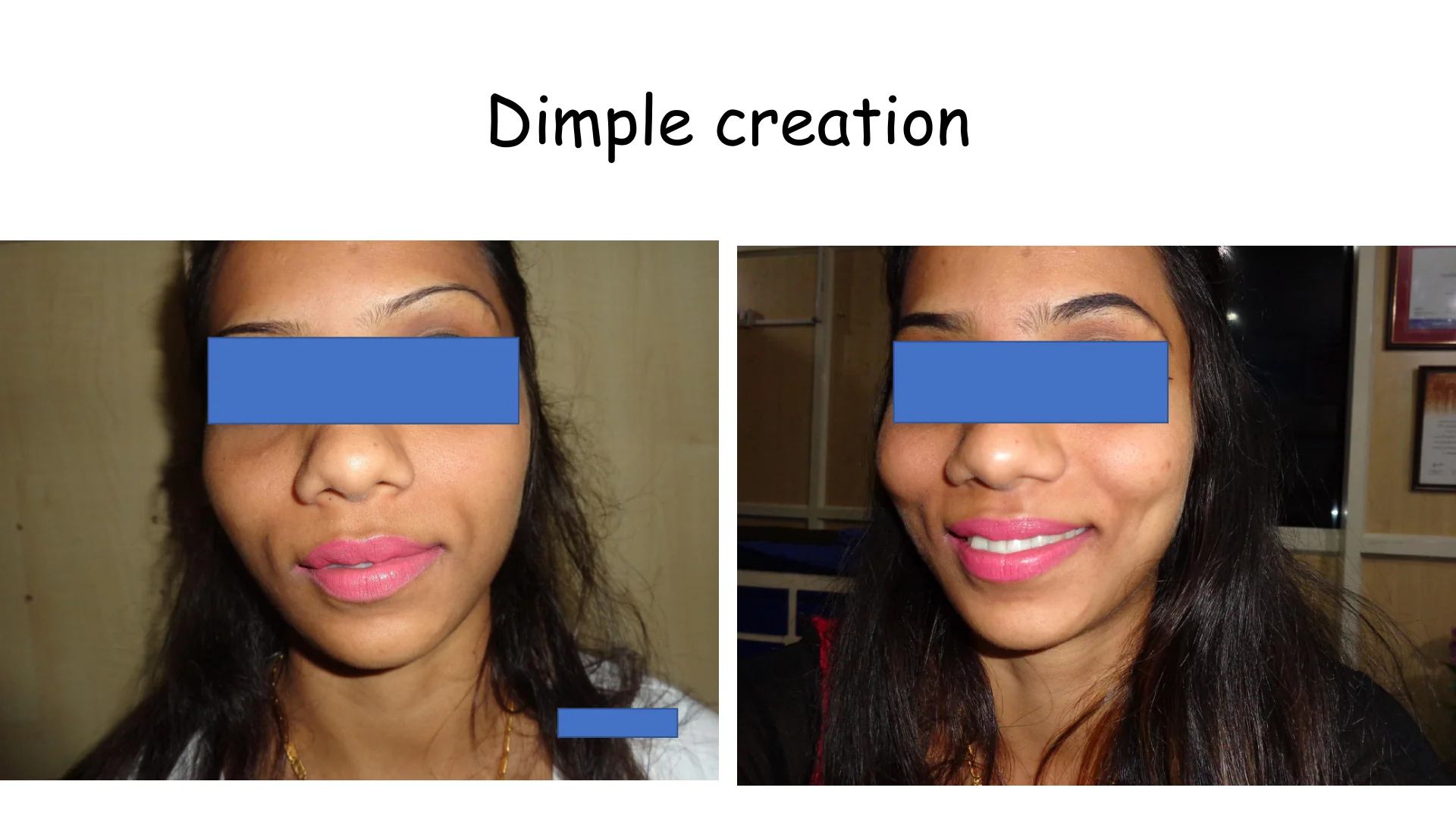 Dimple Creation 12