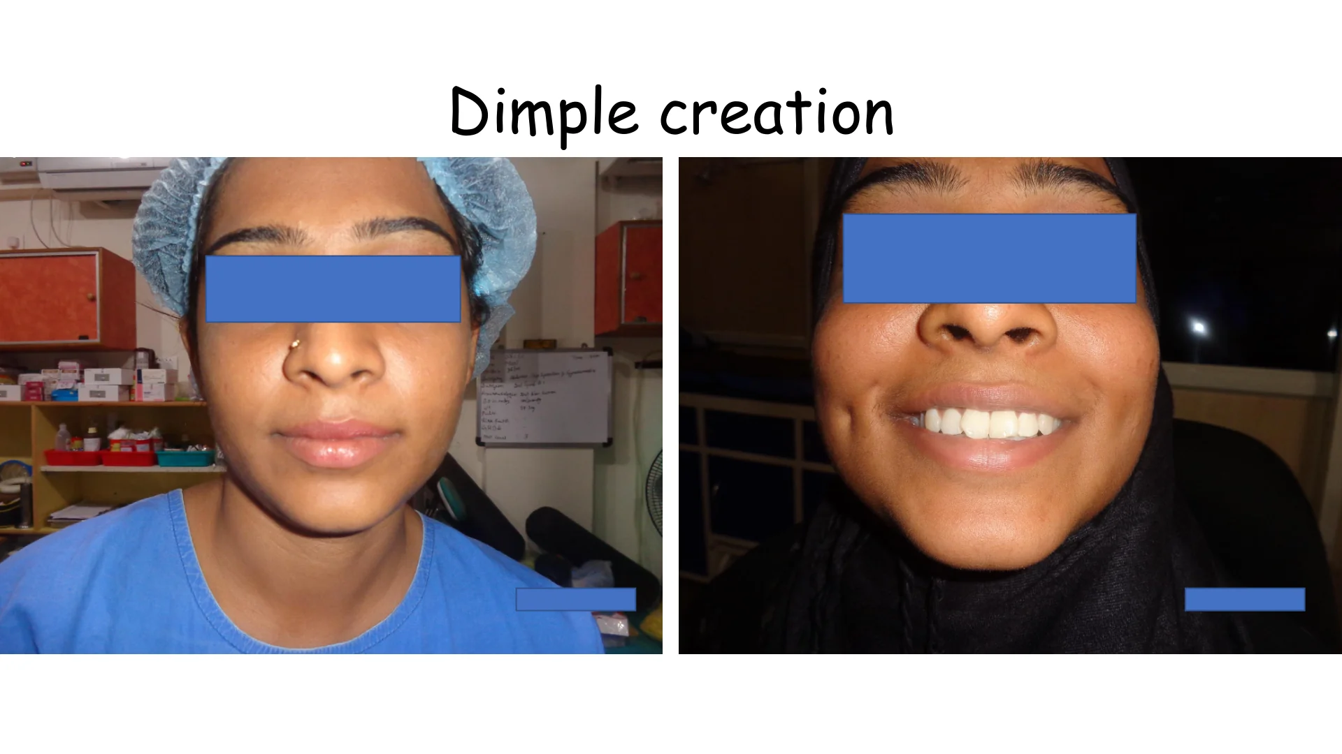 Dimple Creation 13