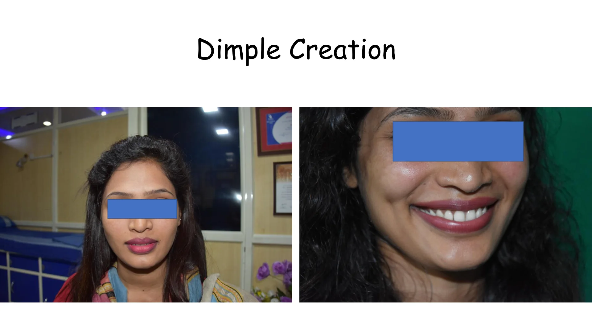 Dimple Creation 7