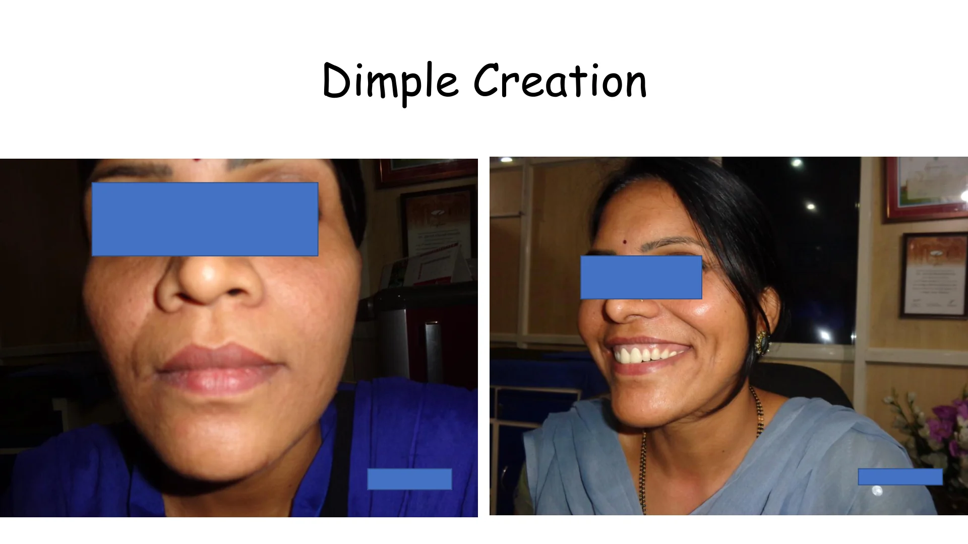 Dimple Creation 8