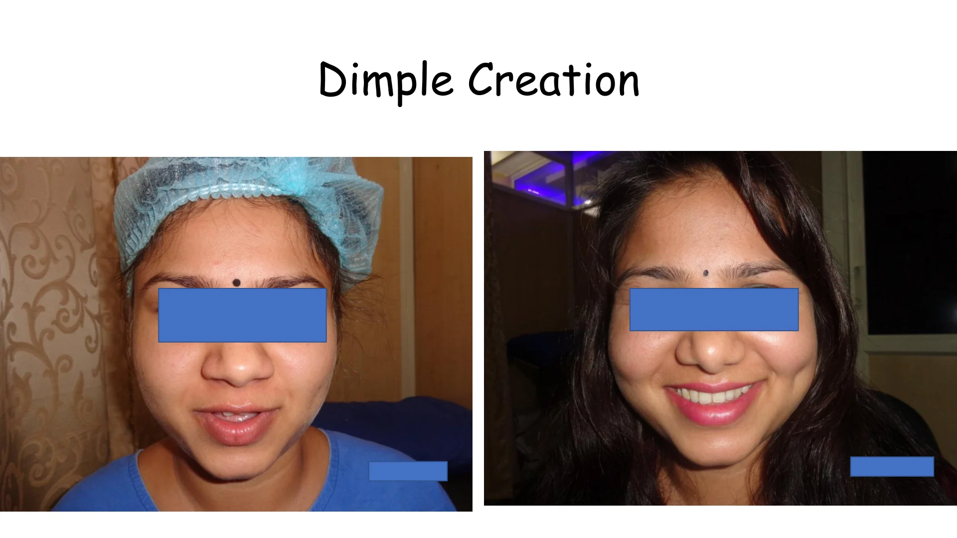 Dimple Creation 9