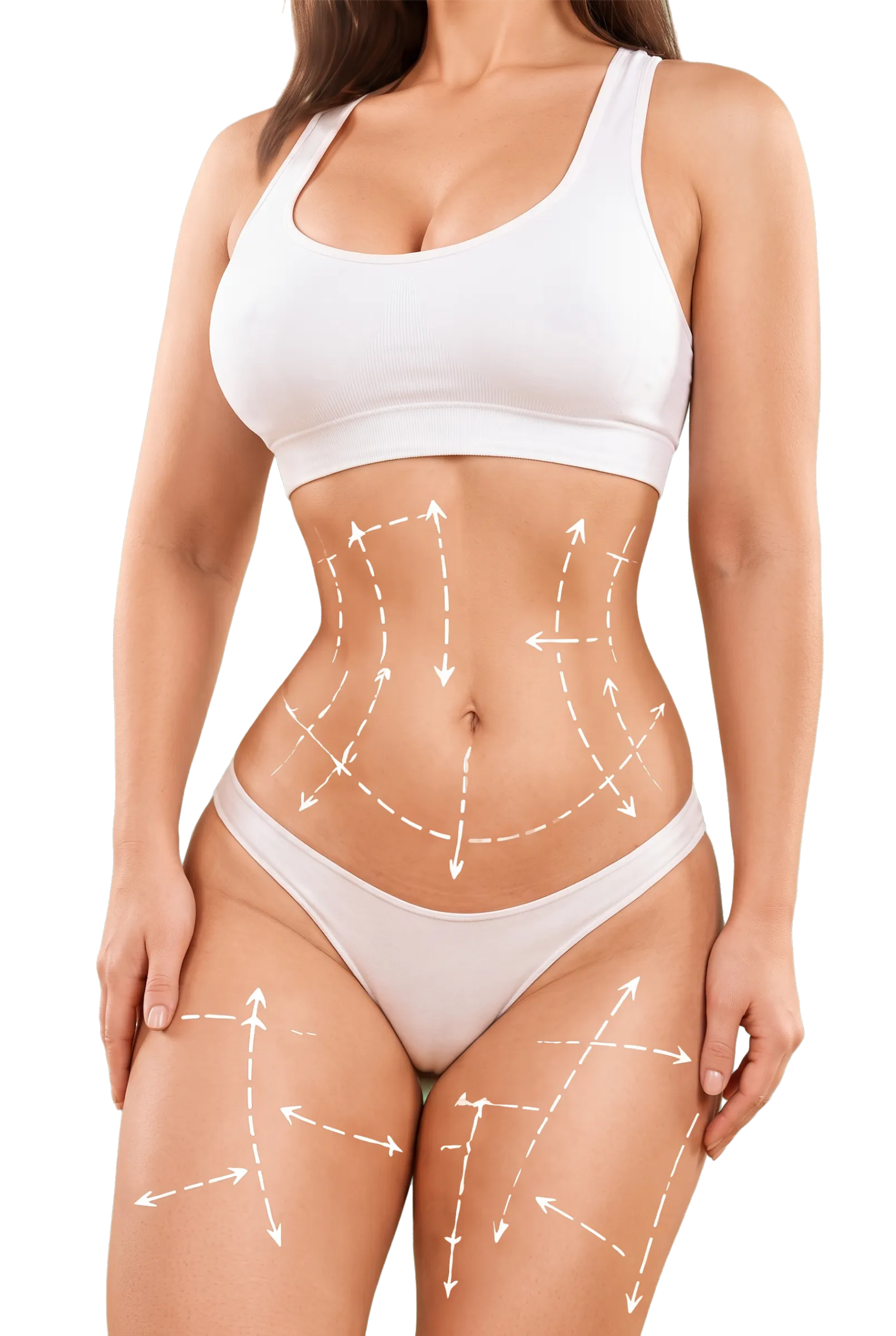 Post Bariatric Surgery Body Contouring in Bangalore