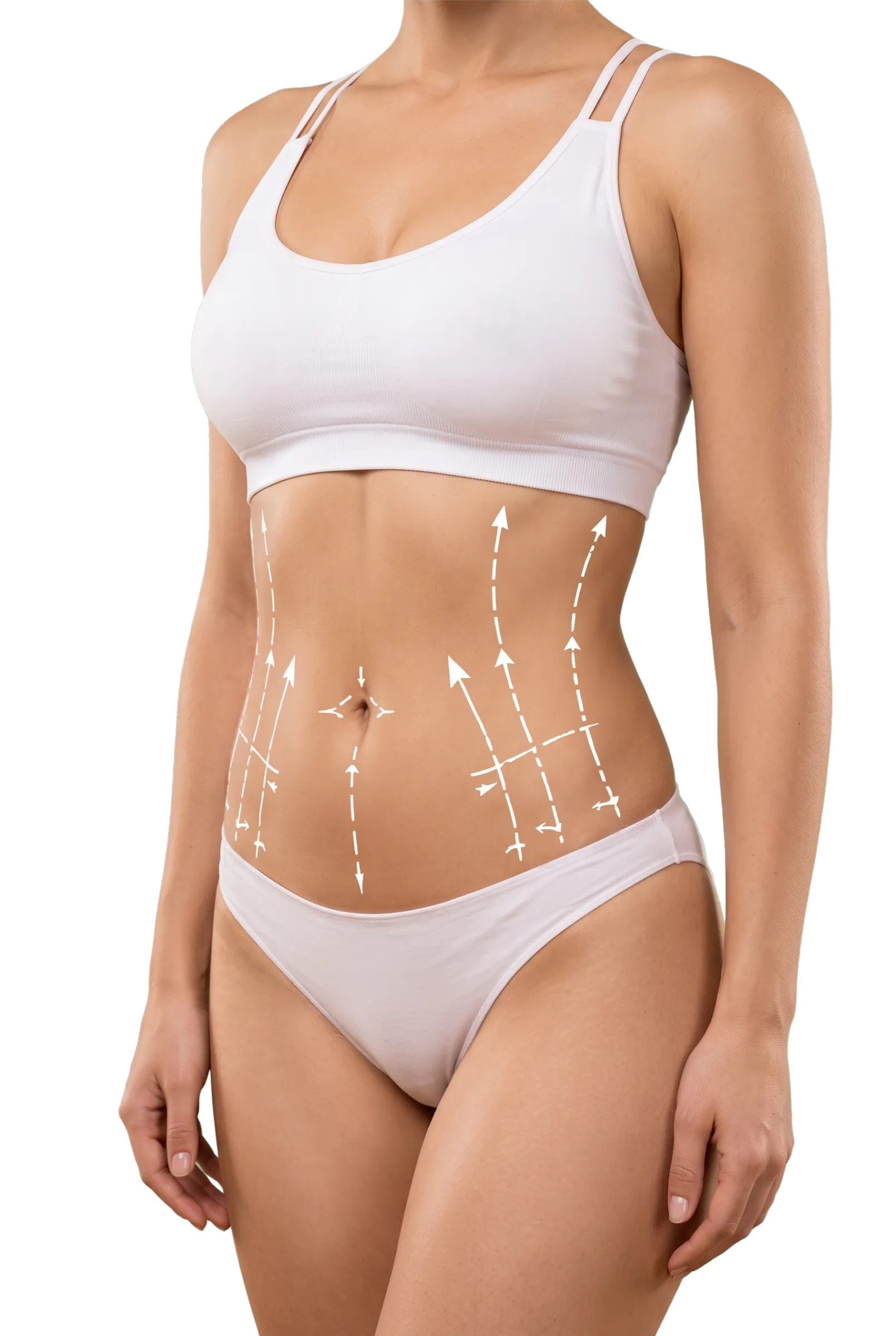 Tummy Tuck in Bangalore