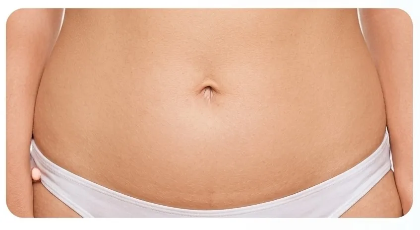 Extended Tummy Tuck