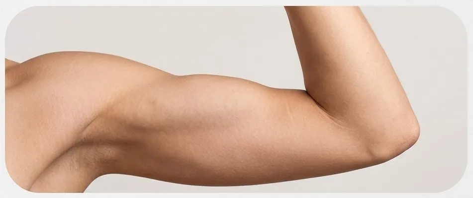 Arms