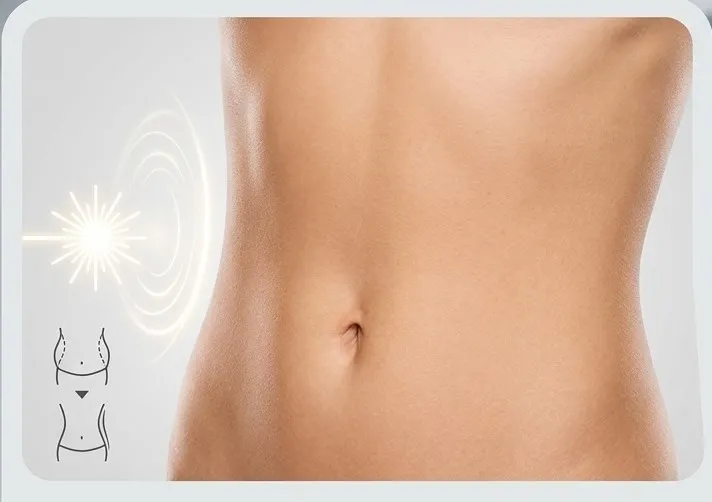 Laser Liposuction