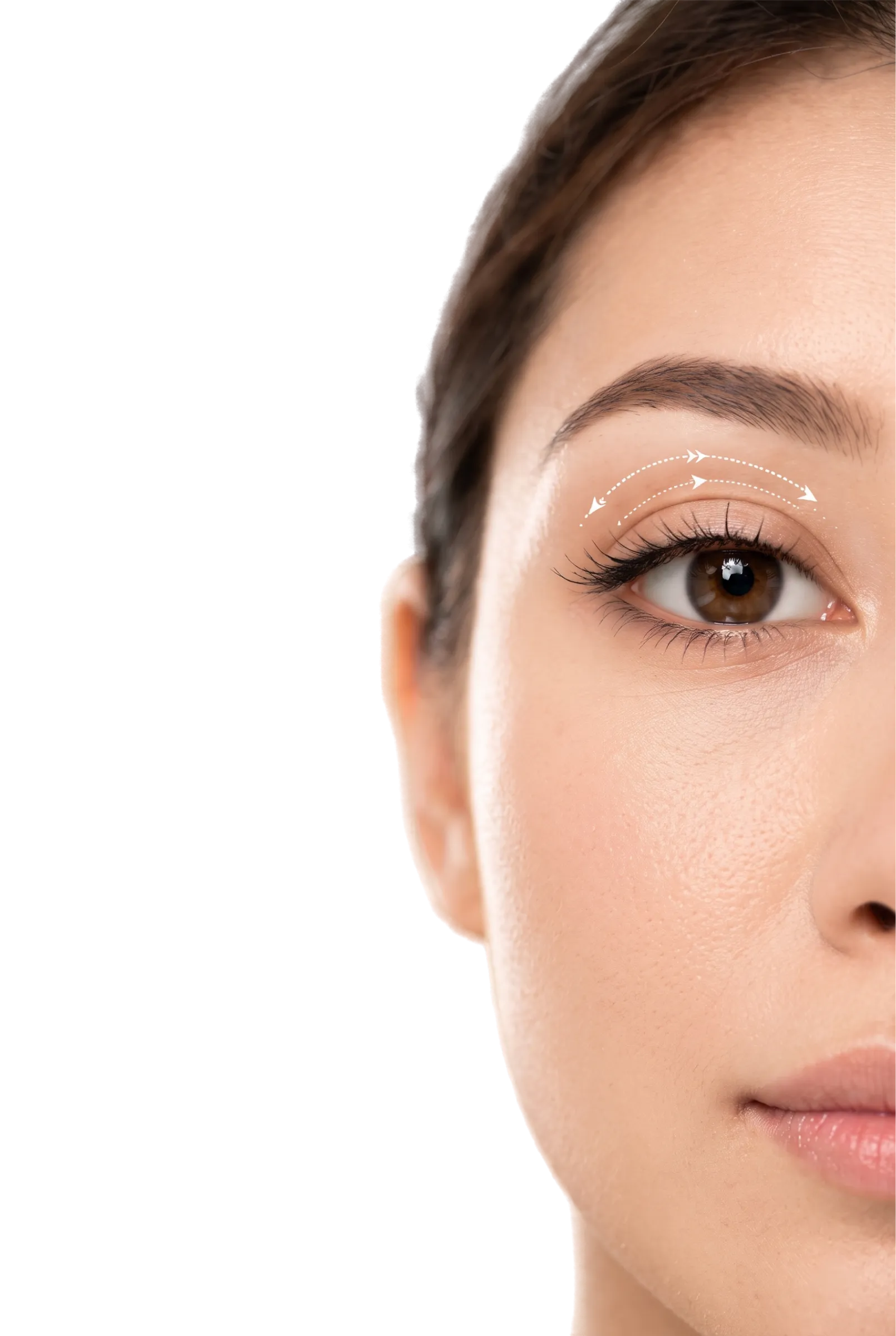 Asian Blepharoplasty Double Eyelid Surgery in Bangalore