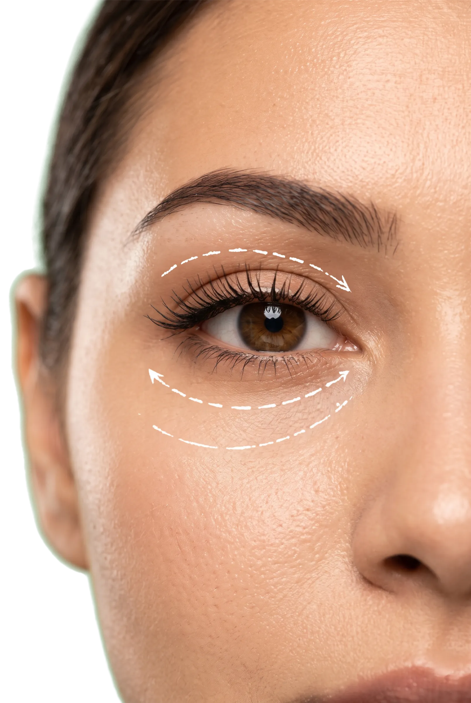 Blepharoplasty in Bangalore