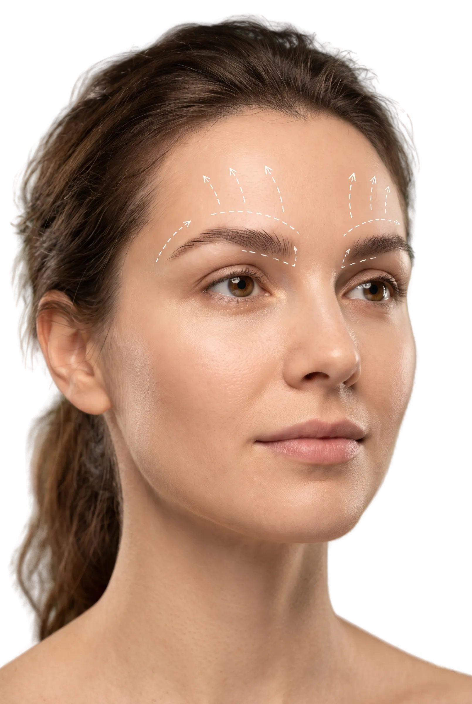 Brow Lift & Forehead Lift in Bangalore