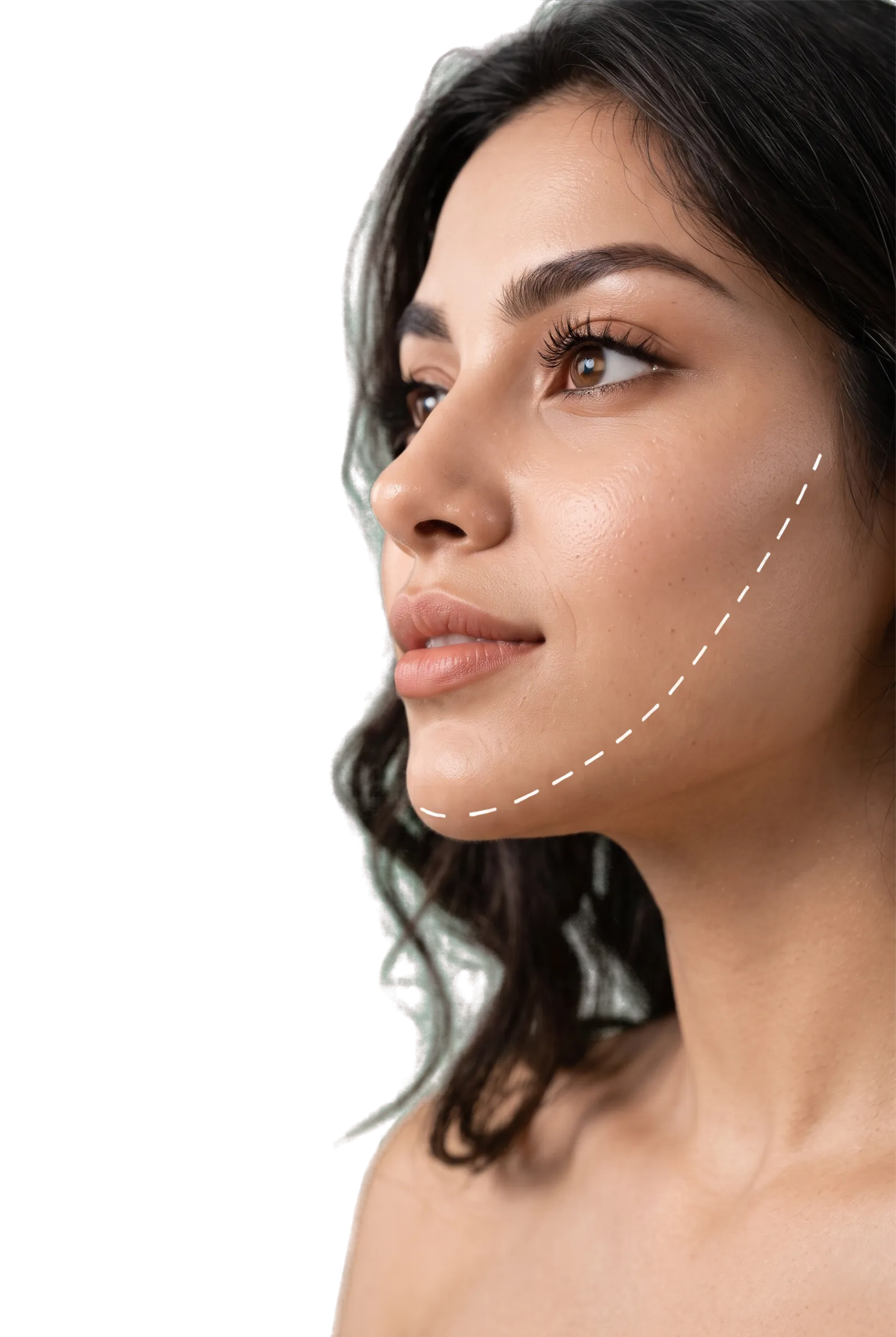 Cheek Liposuction in Bangalore
