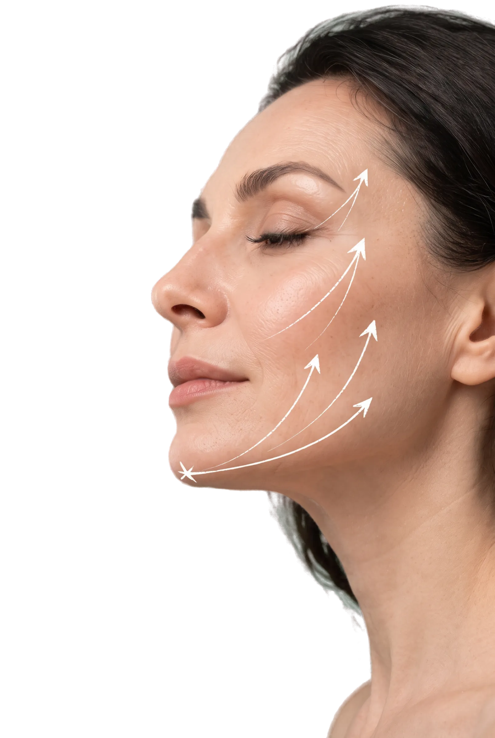 Deep Plane Facelift in Bangalore