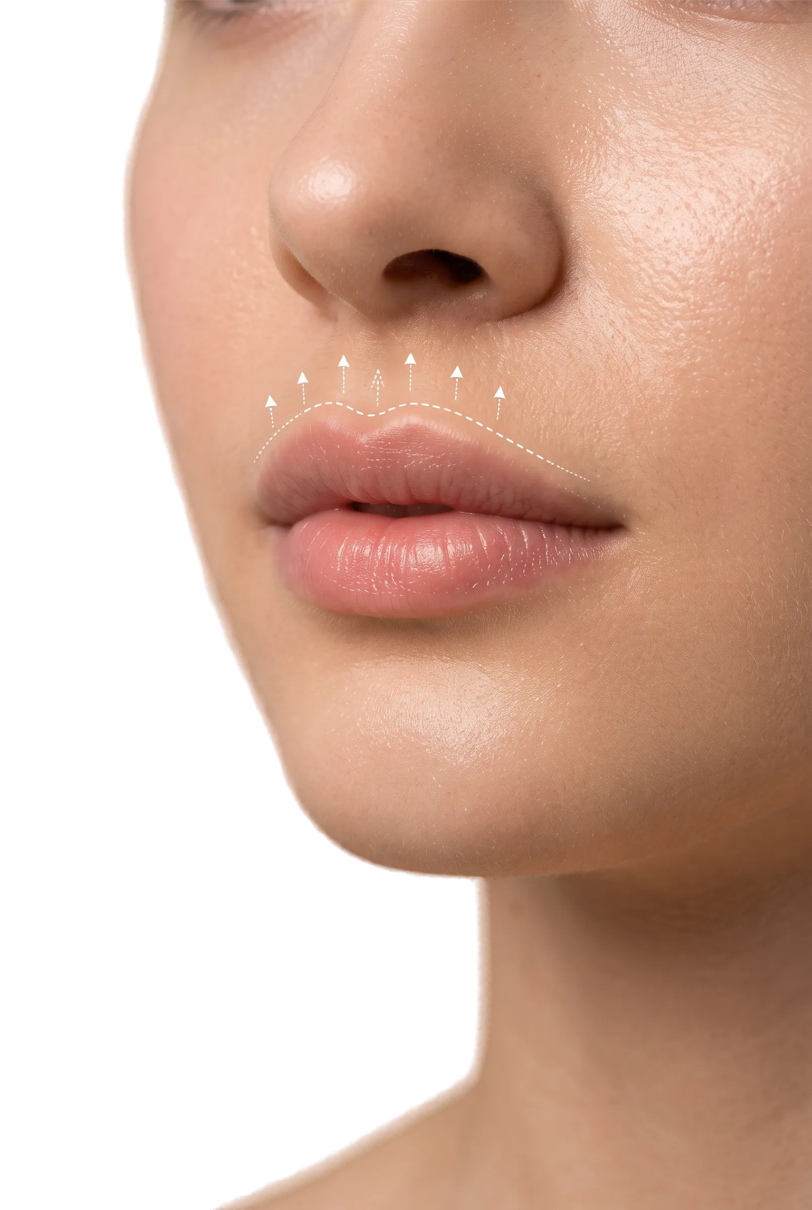 Lip Reduction in Bangalore