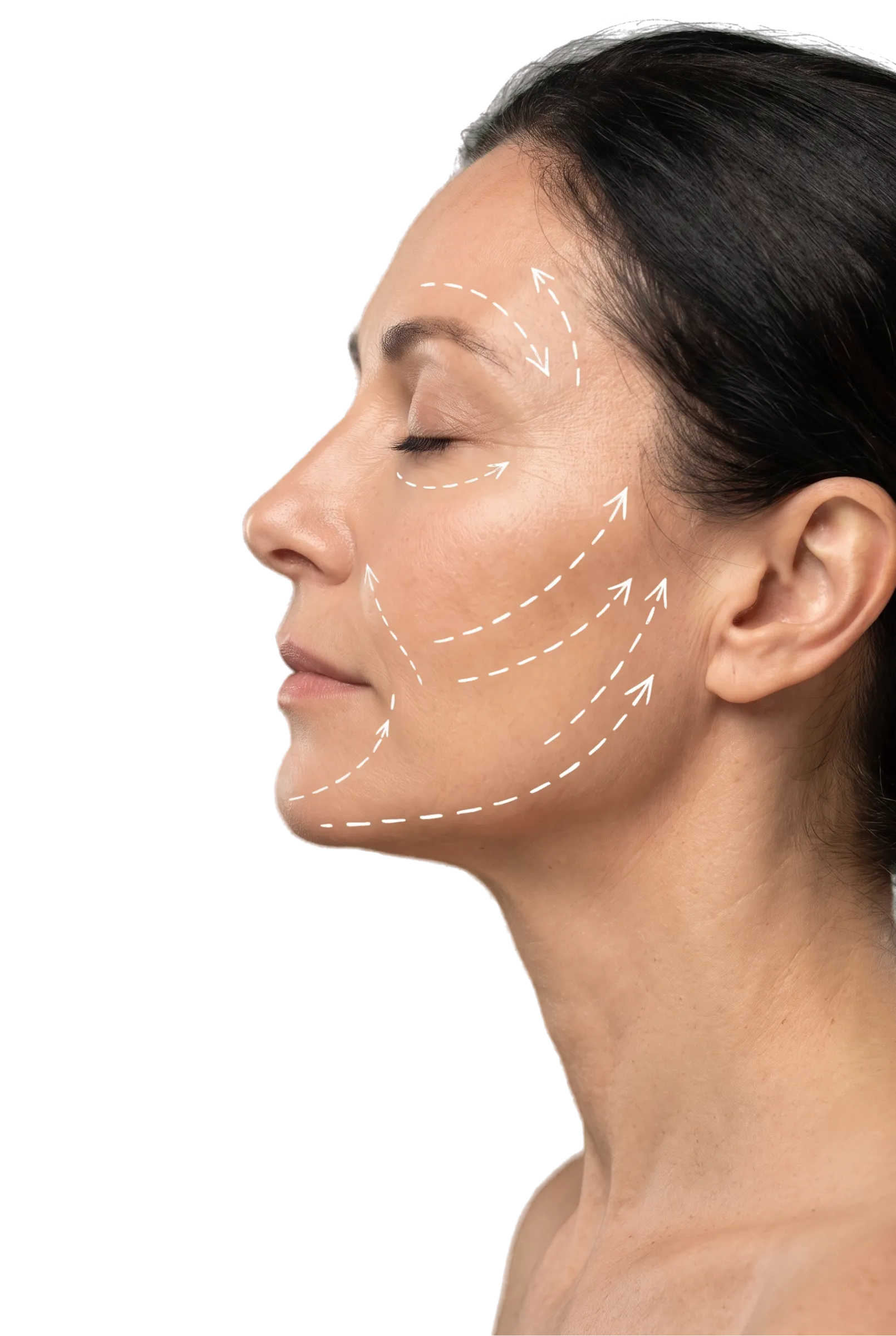 Mini Face Lift in Bangalore