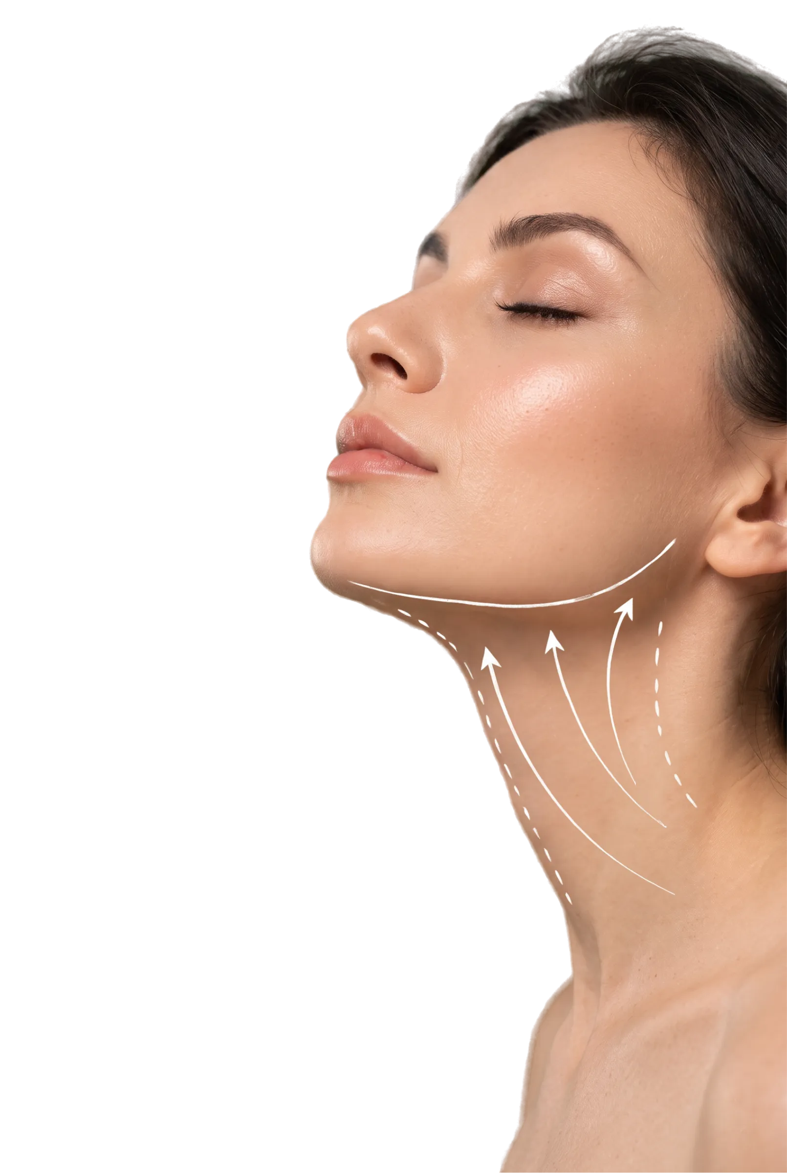 Neck Lift in Bangalore