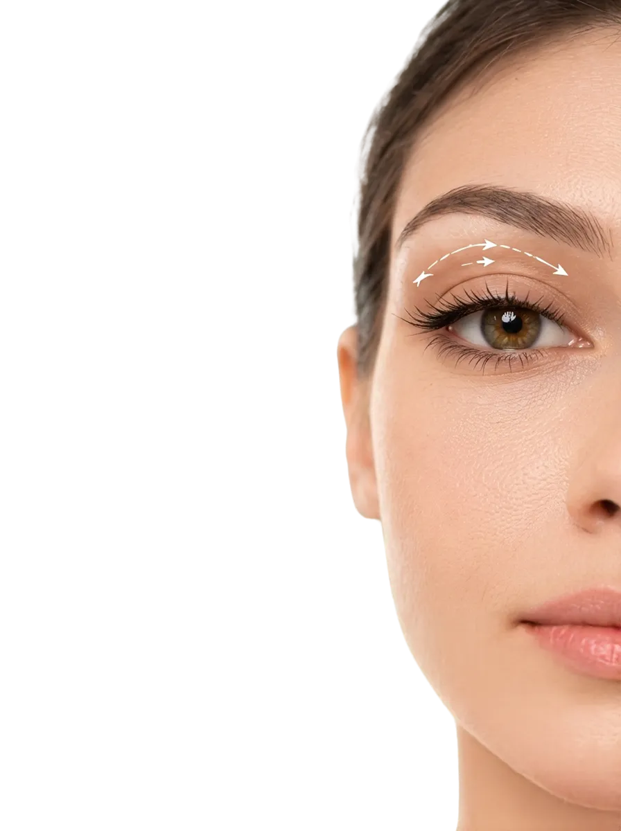 Upper Blepharoplasty in Bangalore