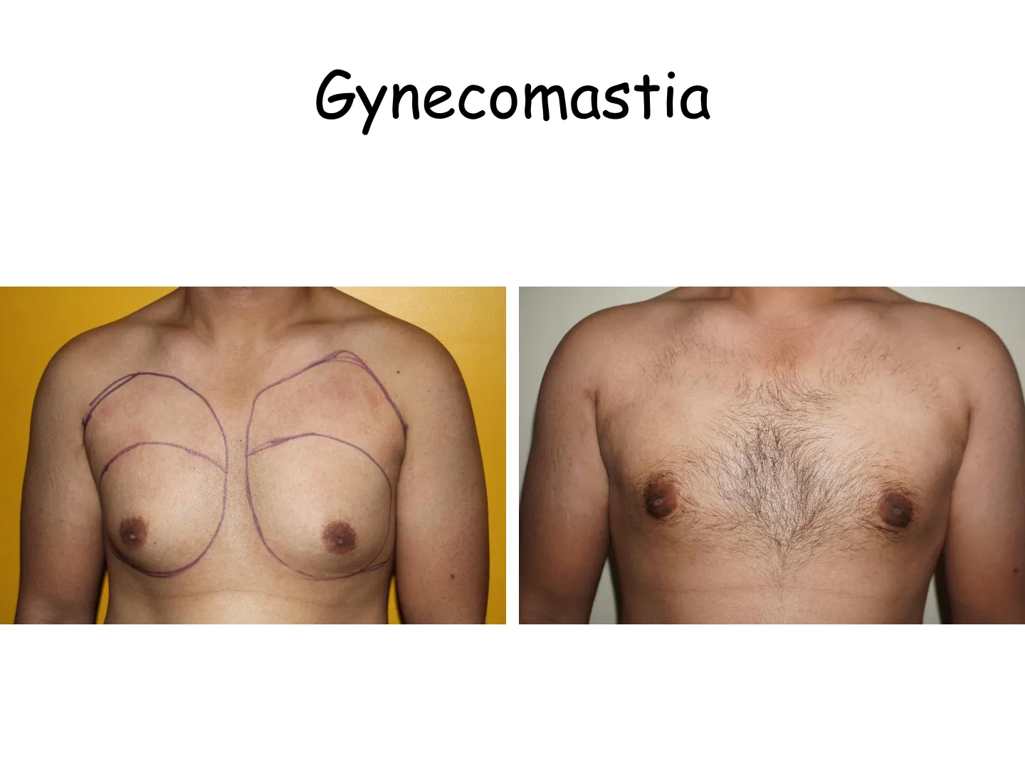 Transformation