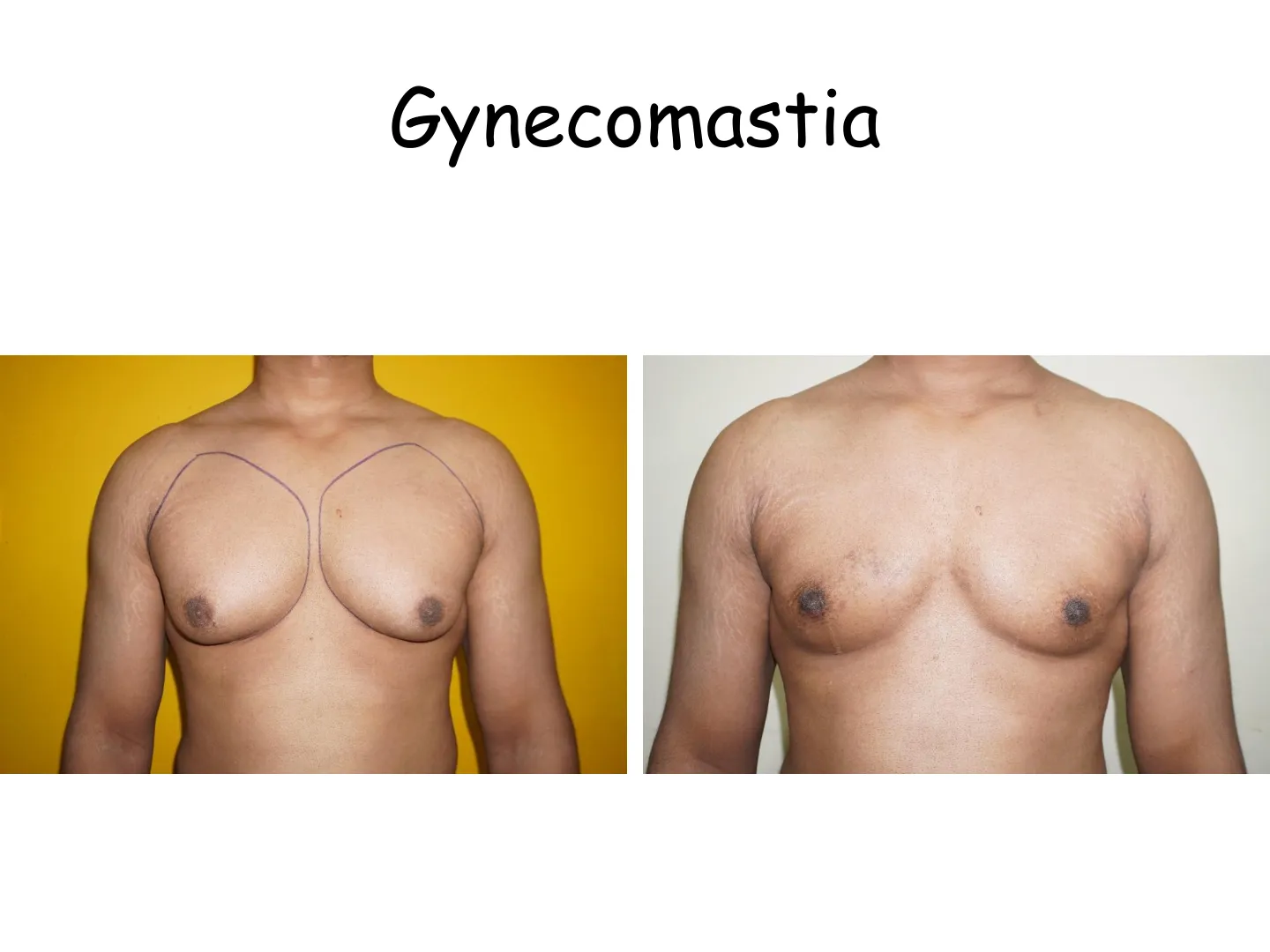 Transformation