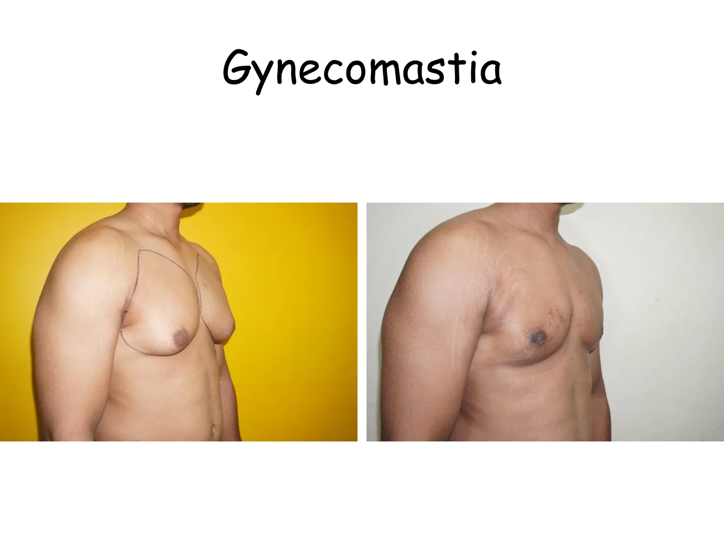 Transformation