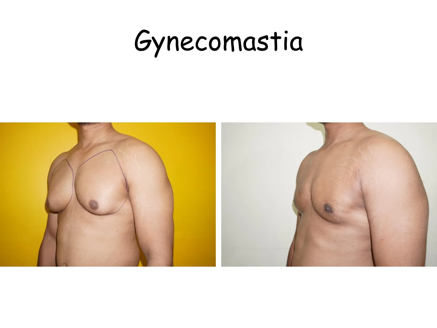 Transformation