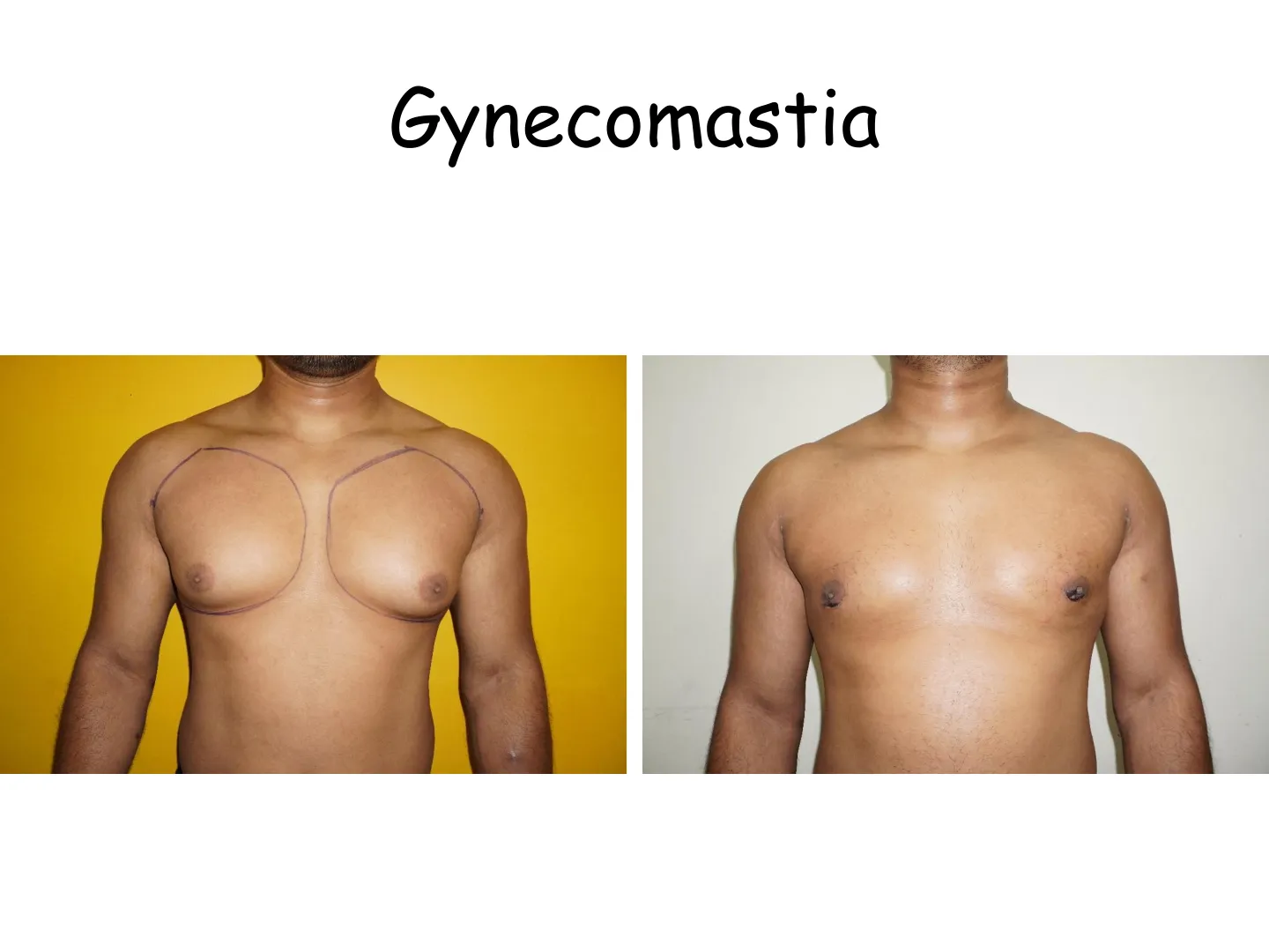 Transformation