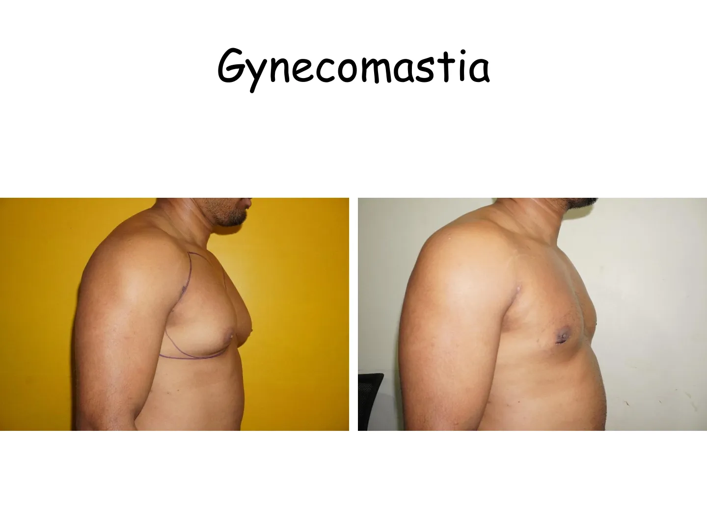 Transformation