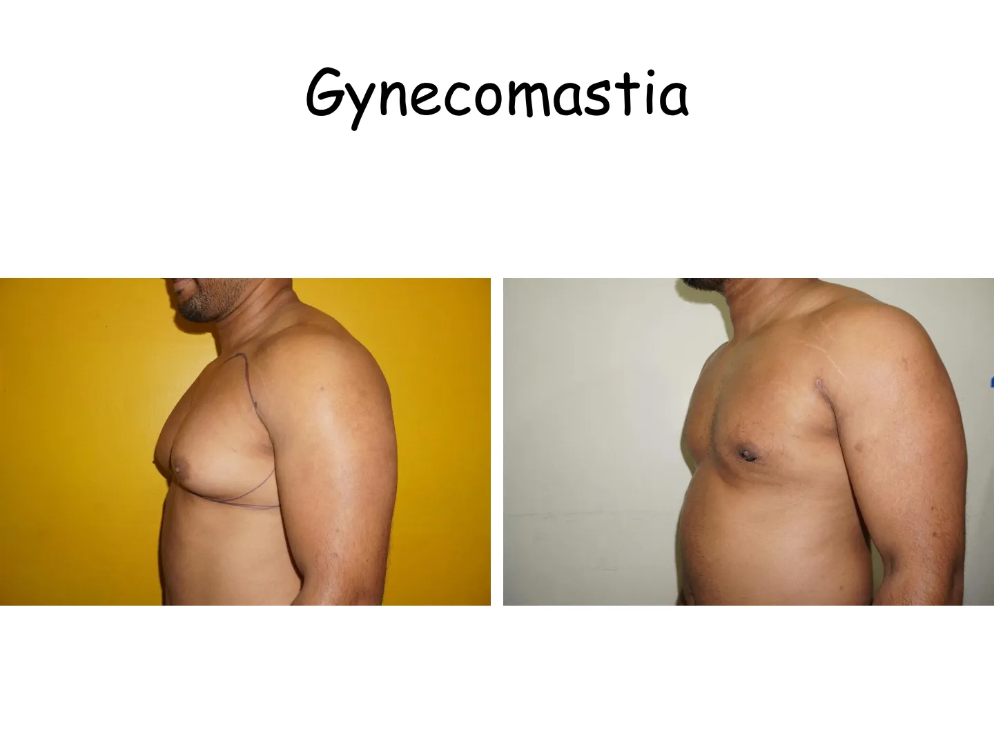 Transformation