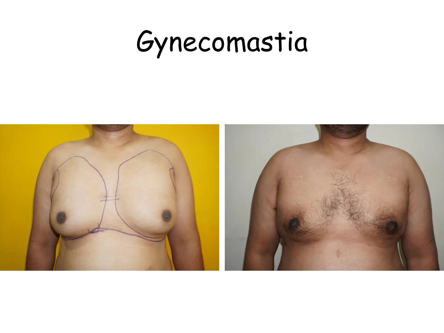 Transformation