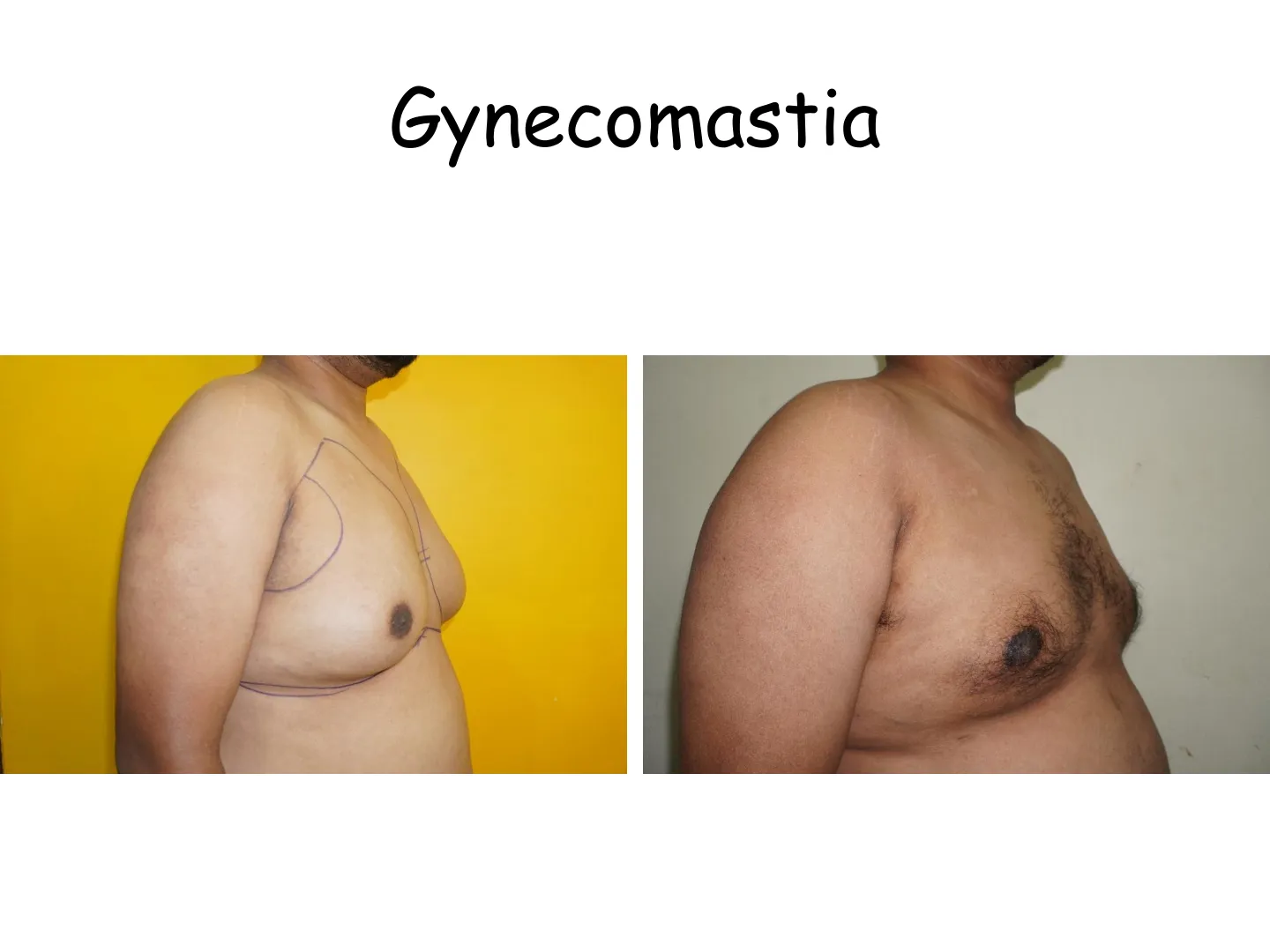 Transformation