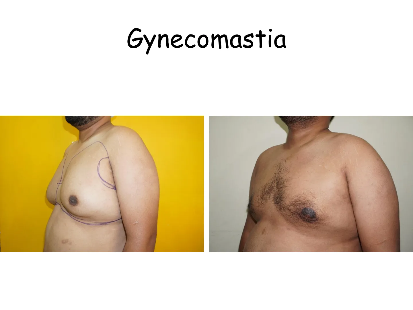 Transformation