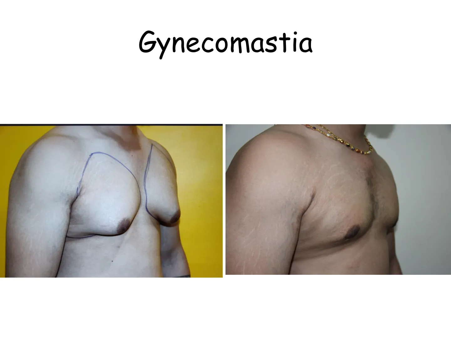 Transformation