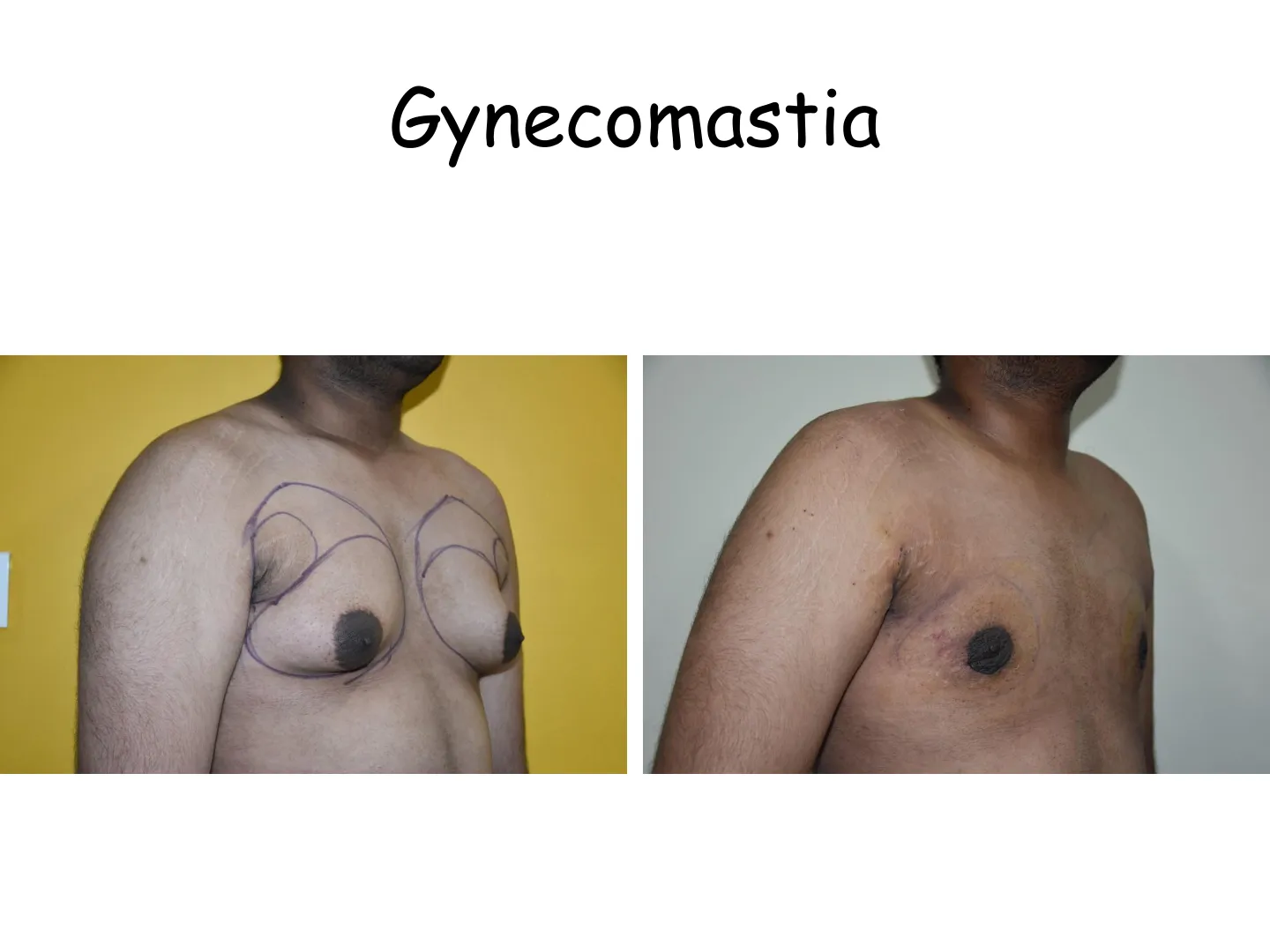 Transformation