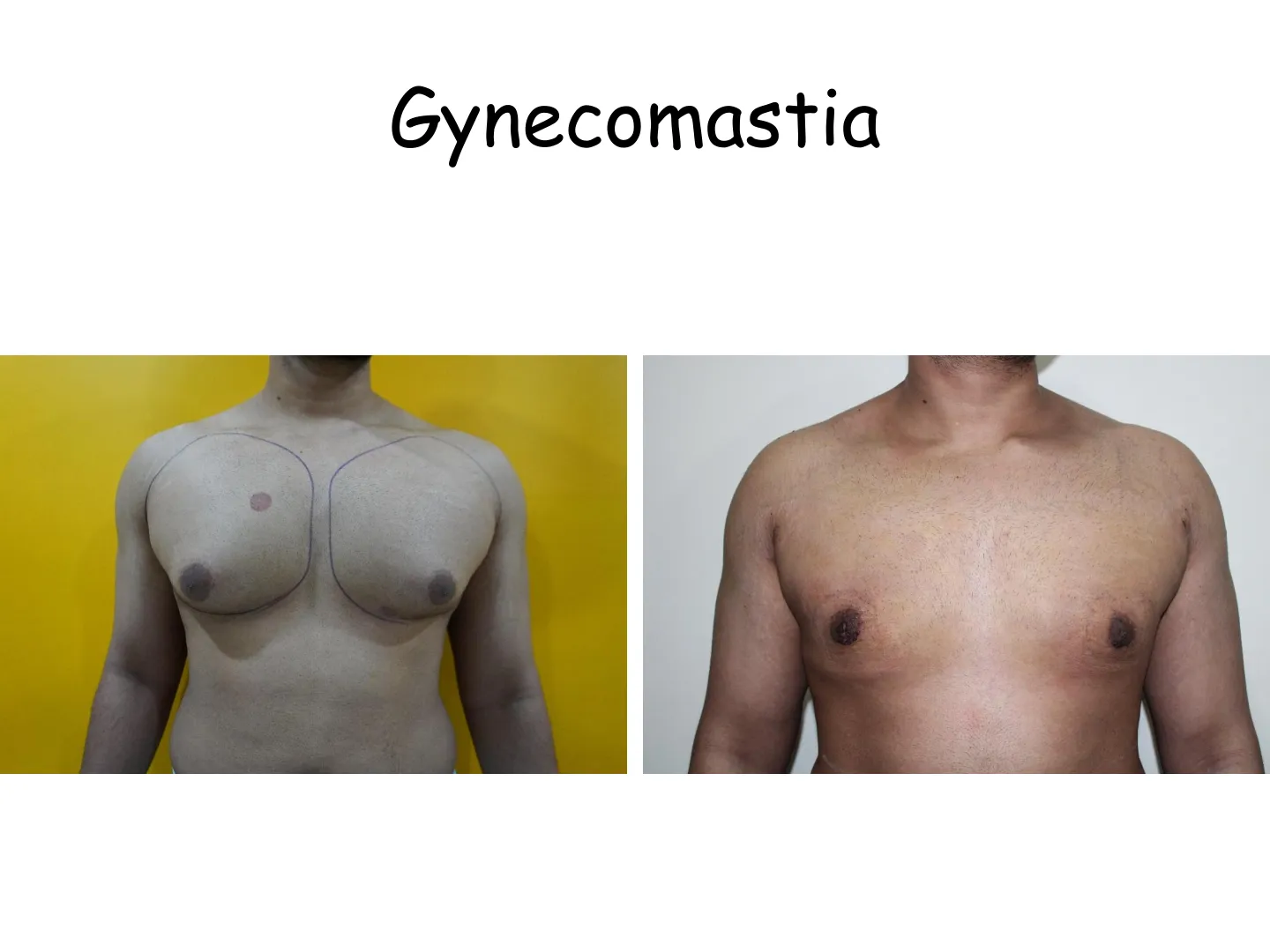 Transformation