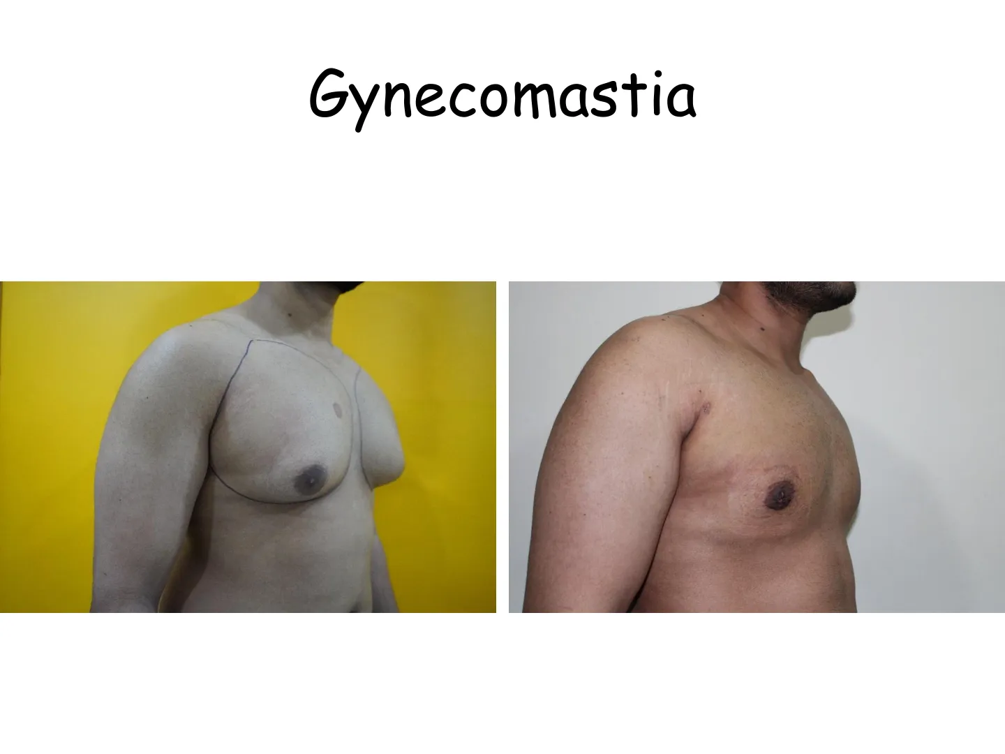 Transformation