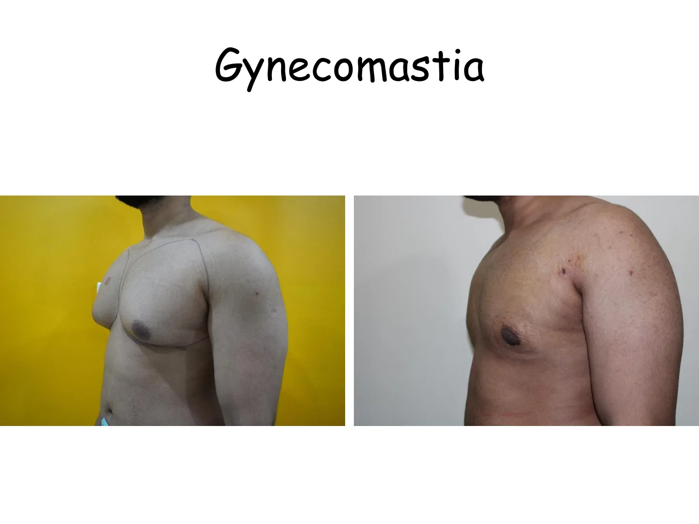Transformation
