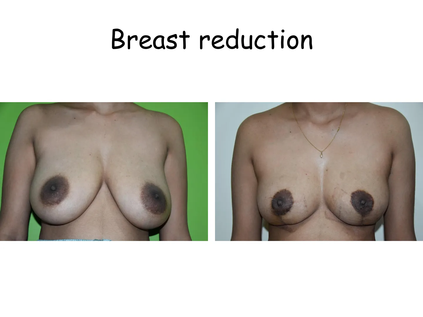 Transformation