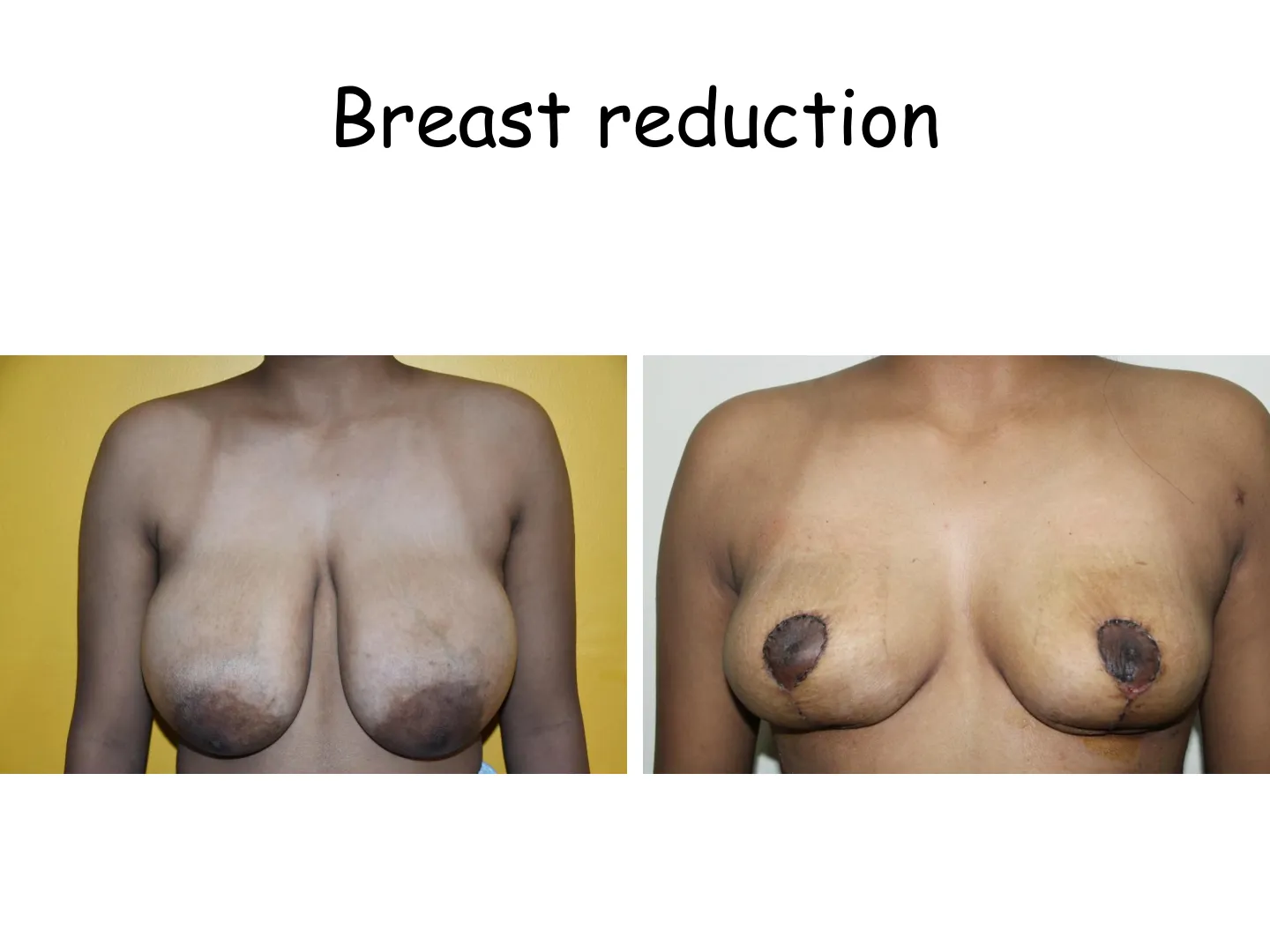 Transformation
