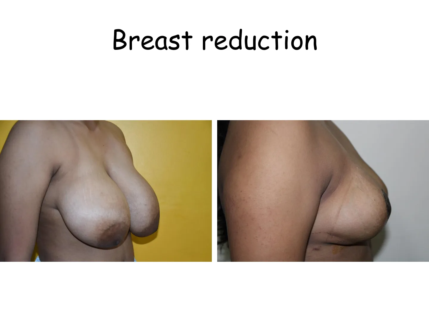 Transformation