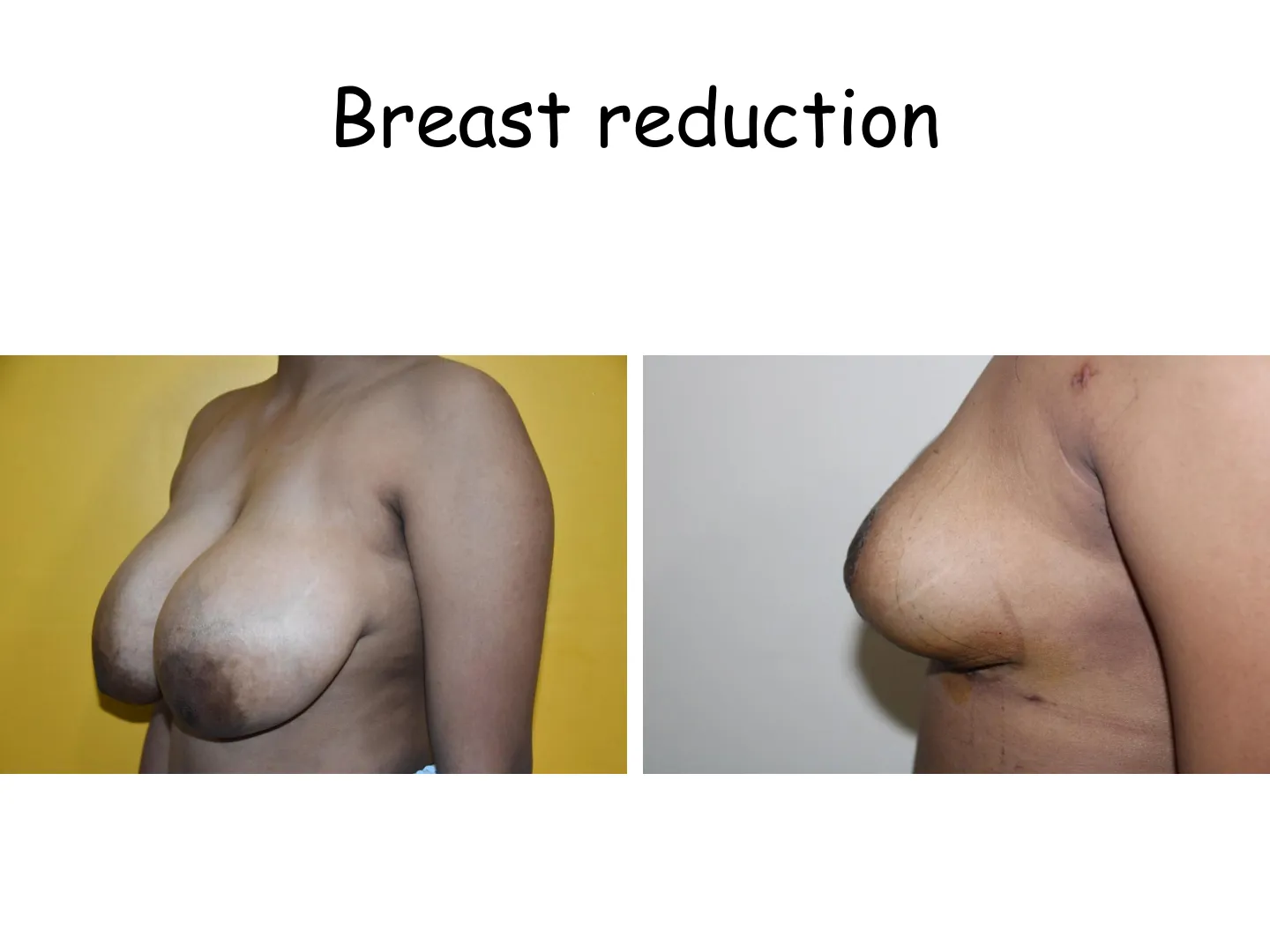 Transformation